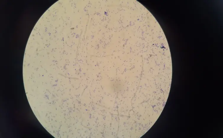 Microscopy of activated sludge biomass